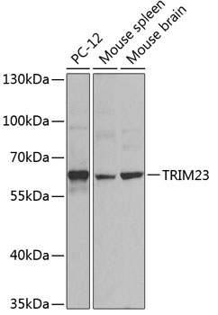 Western blot analysis of extracts of various cell lines using TRIM23 Polyclonal Antibody at dilution of 1:1000.