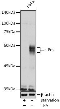 Western blot analysis of extracts of HeLa cells using c-Fos Polyclonal Antibody at 1:1000 dilution.HeLa cells were treated by PMA/TPA (200 nM) at 37°C for 15 minutes after serum-starvation overnight.