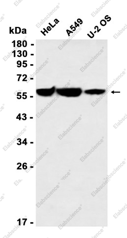 Recombinant Glucose 6 Phosphate Dehydrogenase Monoclonal Antibody - 1