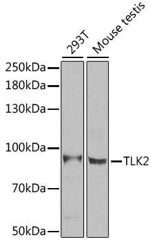 Western blot analysis of extracts of various cell lines using TLK2 Polyclonal Antibody at 1:1000 dilution.