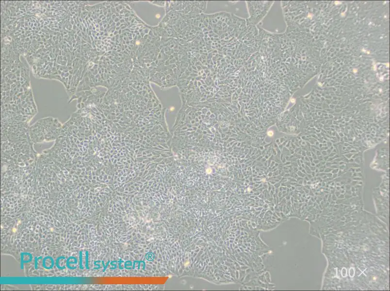 HCT-8 [HRT-18] Cell Complete Medium - 2