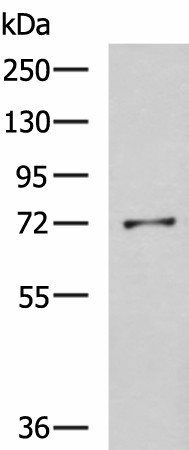 Western blot analysis of K562 cell lysate  using GSTCD Polyclonal Antibody at dilution of 1:800