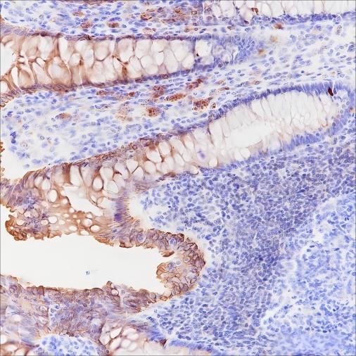 Recombinant c-erbB-3/HER-3 Monoclonal Antibody-searchlist-1