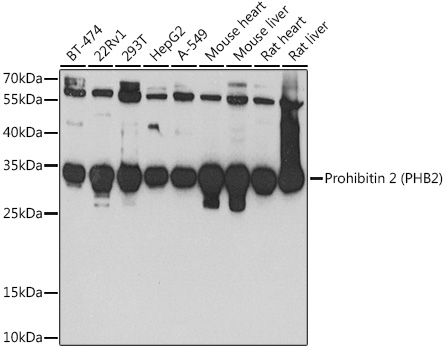 Western blot analysis of extracts of various cell lines using Prohibitin 2 (Prohibitin 2 (PHB2)) Polyclonal Antibody at 1:1000 dilution.