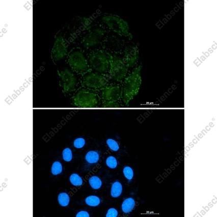 Recombinant Integrin alpha V Monoclonal Antibody - 3