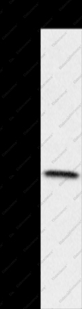 HSD17B8 Polyclonal Antibody - 1
