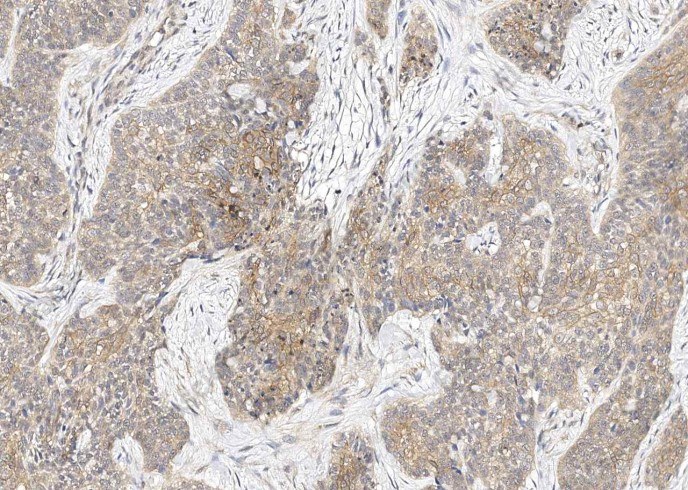 TROP2/TACSTD2 Monoclonal Antibody - 9