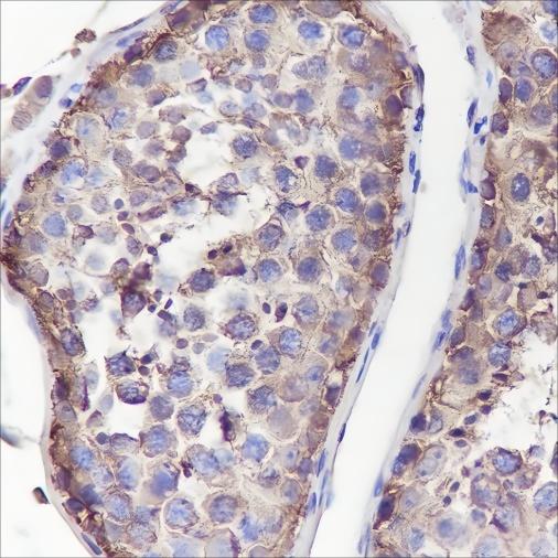 Recombinant Muscarinic Acetylcholine Receptor 2/CM2 Monoclonal Antibody - 2