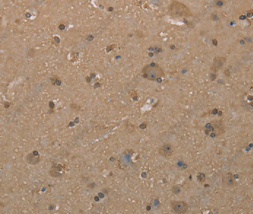 CAB39 Polyclonal Antibody - 2