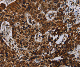NDUFA4 Polyclonal Antibody - 3