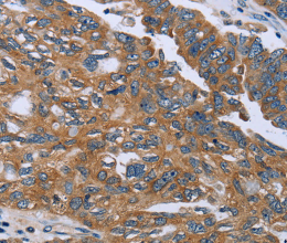 GAB2 Polyclonal Antibody - 2