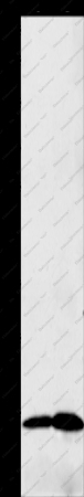 LHB Polyclonal Antibody - 1