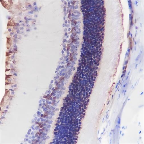 Recombinant CRALBP Monoclonal Antibody - 2