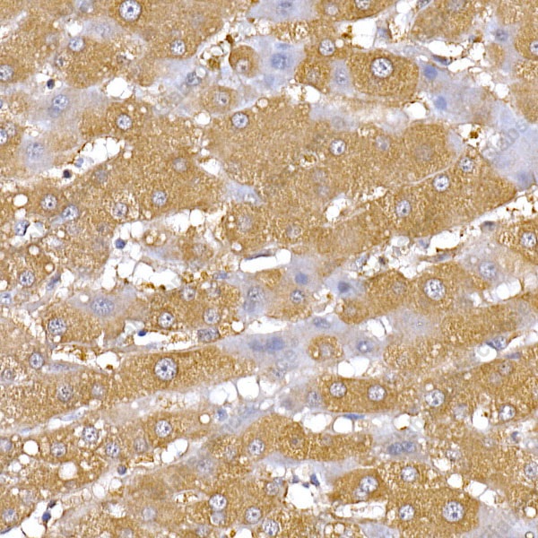 PGC1 alpha Polyclonal Antibody - 7