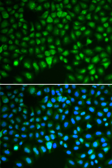 Immunofluorescence analysis of HeLa cells using DLGAP5 Polyclonal Antibody