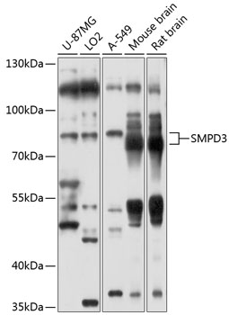 Western blot analysis of extracts of various cell lines using SMPD3 Polyclonal Antibody at 1:1000 dilution.