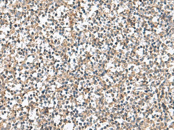 Immunohistochemistry of paraffin-embedded Human tonsil tissue  using PTPRS Polyclonal Antibody at dilution of 1:110(?200)