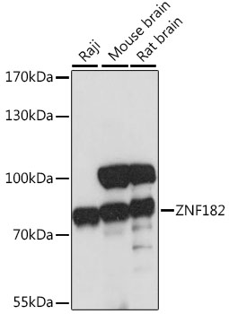 Western blot analysis of extracts of various cell lines using ZNF182 Polyclonal Antibody at 1:1000 dilution.