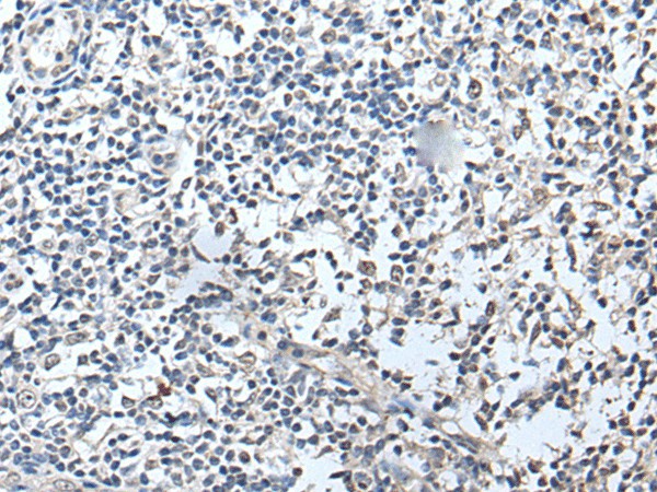 Immunohistochemistry of paraffin-embedded Human tonsil tissue  using RERG Polyclonal Antibody at dilution of 1:50(?200)