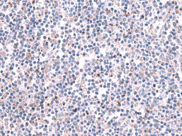 Immunohistochemistry of paraffin-embedded Human tonsil tissue  using KCNK10 Polyclonal Antibody at dilution of 1:35(?200)