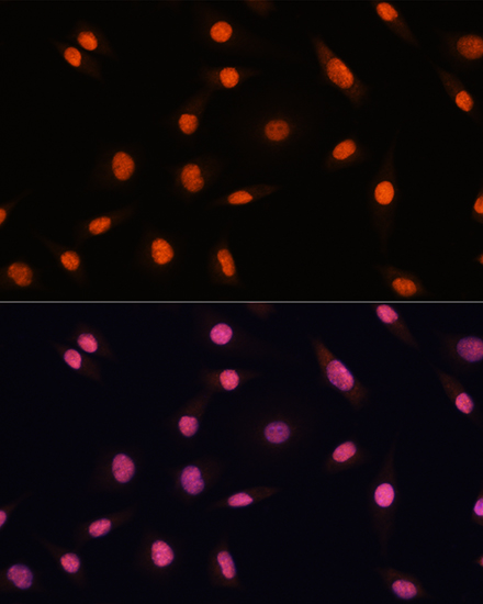 Immunofluorescence analysis of L929 cells using CHD4 Polyclonal Antibody at dilution of  1:100. Blue: DAPI for nuclear staining.