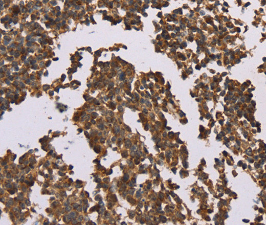 Immunohistochemistry of paraffin-embedded Human tonsil using OTC Polyclonal Antibody at dilution of 1:50