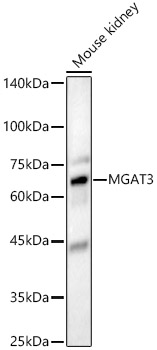 Western blot analysis of Mouse kidney using MGAT3 Polyclonal Antibody at 1:1000 dilution.