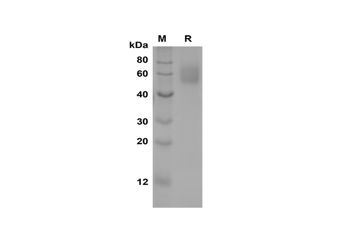 Recombinant Human CDH1 Protein(Sumo Tag)-产品推荐-1