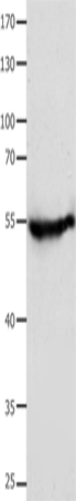 Western Blot analysis of Human fetal muscle tissue  using CAP2 Polyclonal Antibody at dilution of 1:700