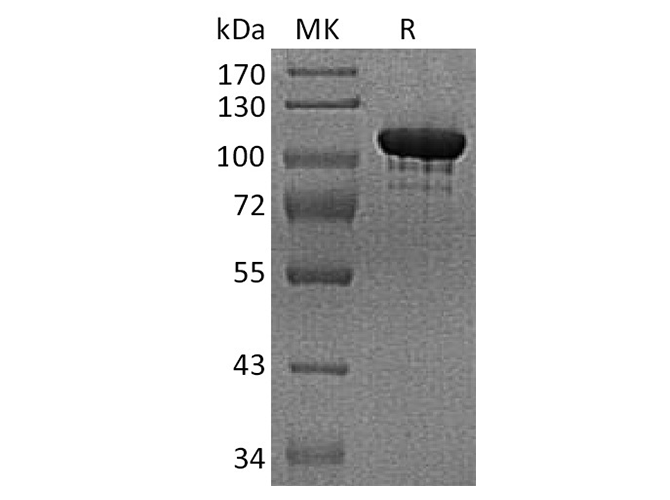 Recombinant Human Autotaxin/ENPP2 Protein (aa 36-863, His Tag)