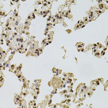 Immunohistochemistry of paraffin-embedded Rat lung using FGF2 Polyclonal Antibody at dilution of  1:100 (40x lens).