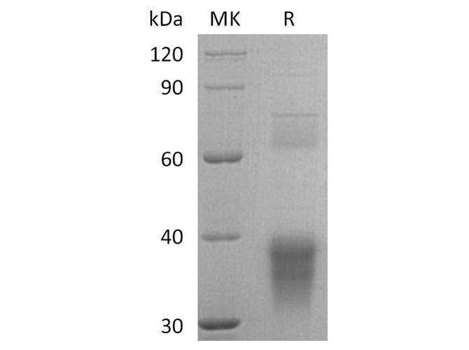 Recombinant Human Clusterin/ApoJ Protein (aa 23-449, His Tag)