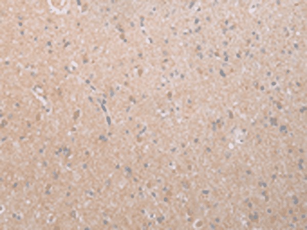 Immunohistochemistry of paraffin-embedded Human brain tissue  using DEFB112 Polyclonal Antibody at dilution of 1:40(?200)