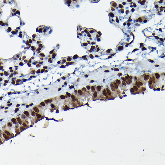 Immunohistochemistry of paraffin-embedded mouse lung using CDK4 Polyclonal Antibody at dilution of 1:100 (40x lens).Perform high pressure antigen retrieval with 10 mM citrate buffer pH 6.0 before commencing with IHC staining protocol.