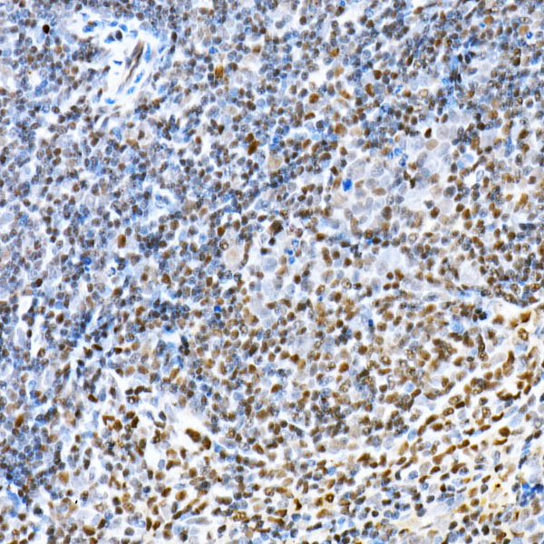 Immunohistochemistry of paraffin-embedded mouse spleen using FOXP1 Polyclonal Antibody at dilution of 1:20 (40x lens).Perform high pressure antigen retrieval with 10 mM citrate buffer pH 6.0 before commencing with IHC staining protocol.