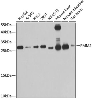 Western blot analysis of extracts of various cell lines using PMM2 Polyclonal Antibody at 1:1000 dilution.