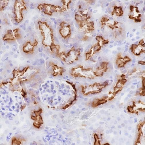 Recombinant CD15/SSEA1 Monoclonal Antibody - 3