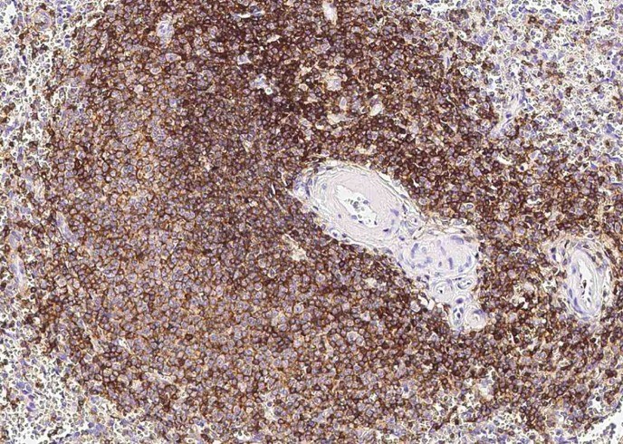 CD45/PTPRC Monoclonal Antibody - small - 2