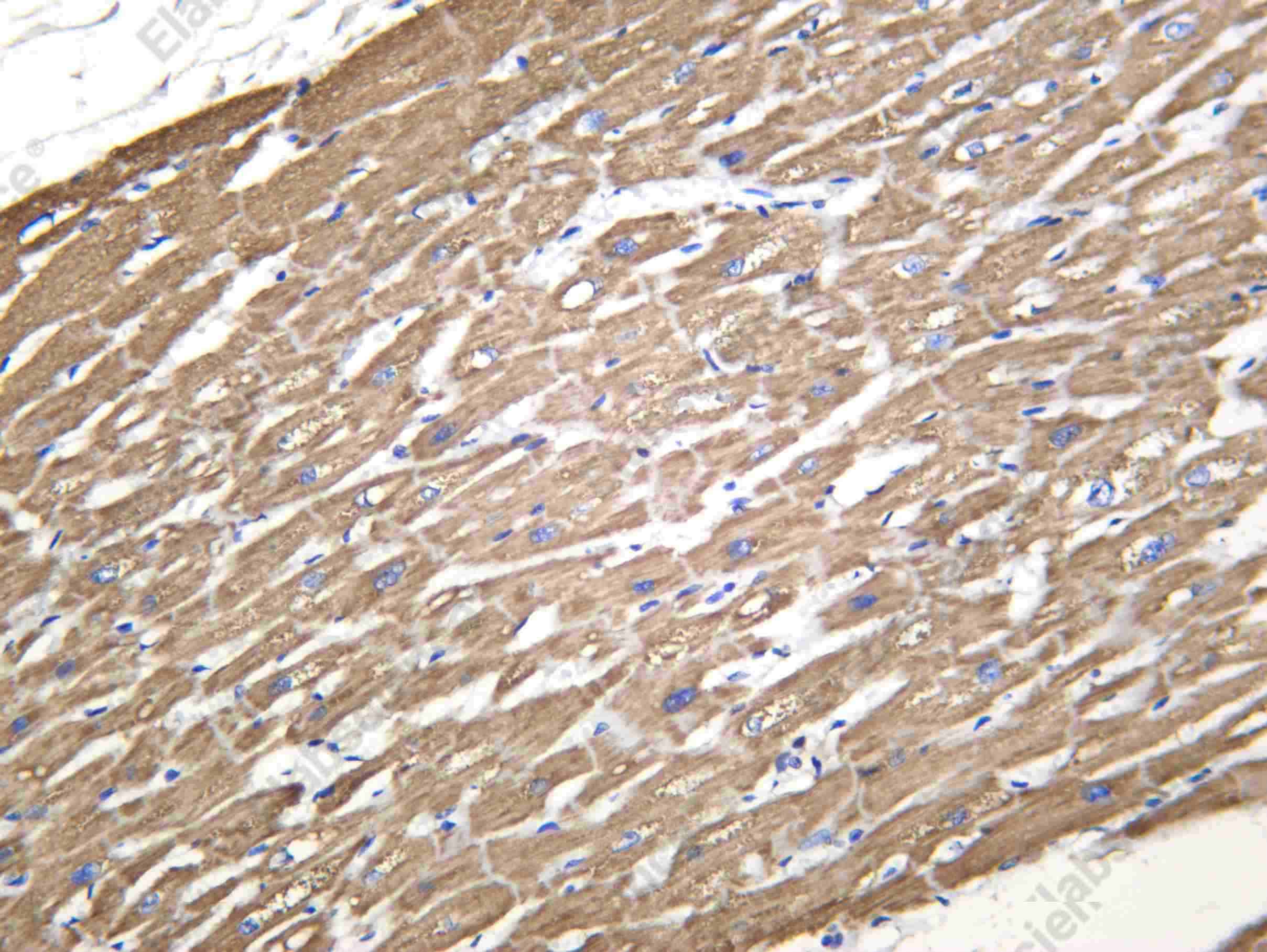 Recombinant ACADV Monoclonal Antibody - 1