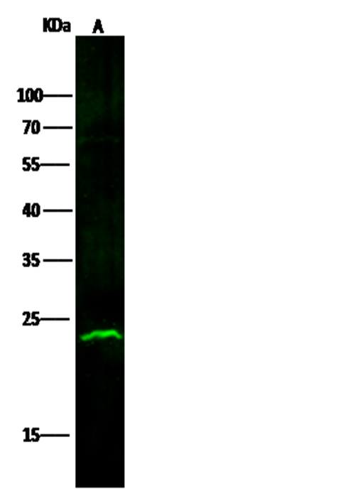 Recombinant ABHD14B Monoclonal Antibody - small - 2