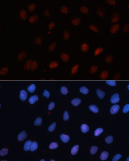 Immunofluorescence analysis of U-2 OS cells using SUMO1 Polyclonal Antibody at dilution of  1:100. Blue: DAPI for nuclear staining.