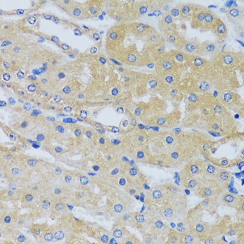 Immunohistochemistry of paraffin-embedded Mouse kidney using CABP7 Polyclonal Antibody at dilution of 1:100 (40x lens).