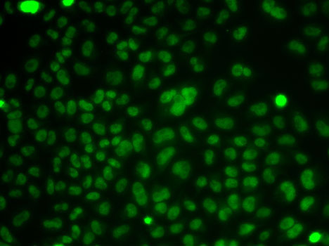 Immunofluorescence analysis of HeLa cells using CSNK2A2 Polyclonal Antibody