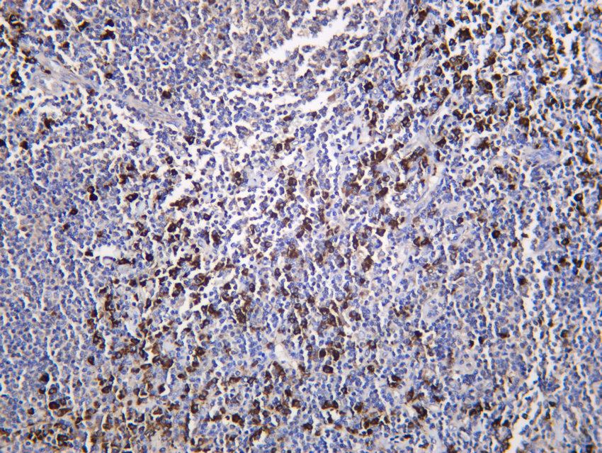 Recombinant Desmoglein 3/PVA Monoclonal Antibody - 2