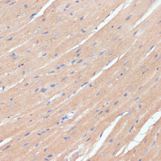 Immunohistochemistry of paraffin-embedded mouse heart using NHLRC1 Polyclonal antibody at dilution of 1:100 (40x lens).Perform microwave antigen retrieval with 10 mM PBS buffer pH 7.2 before commencing with IHC staining protocol.