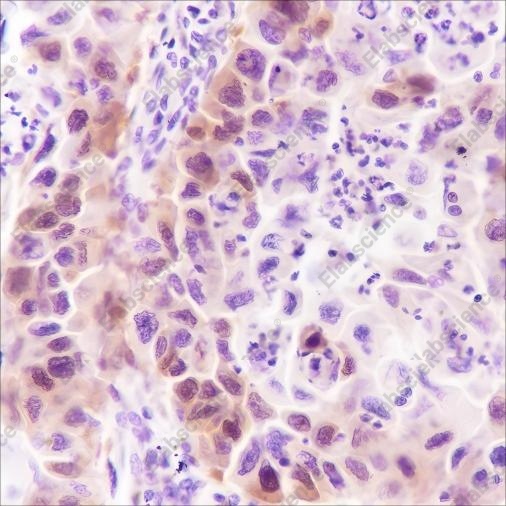 Recombinant Stathmin Monoclonal Antibody - 2