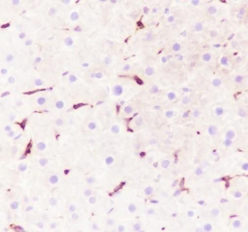 Recombinant Heme Oxygenase 1 Monoclonal Antibody - small - 5