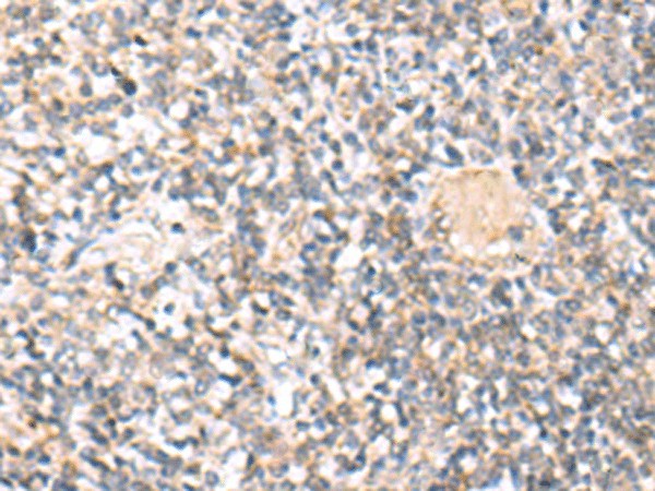 Immunohistochemistry of paraffin-embedded Human tonsil tissue  using IL36A Polyclonal Antibody at dilution of 1:30(?200)