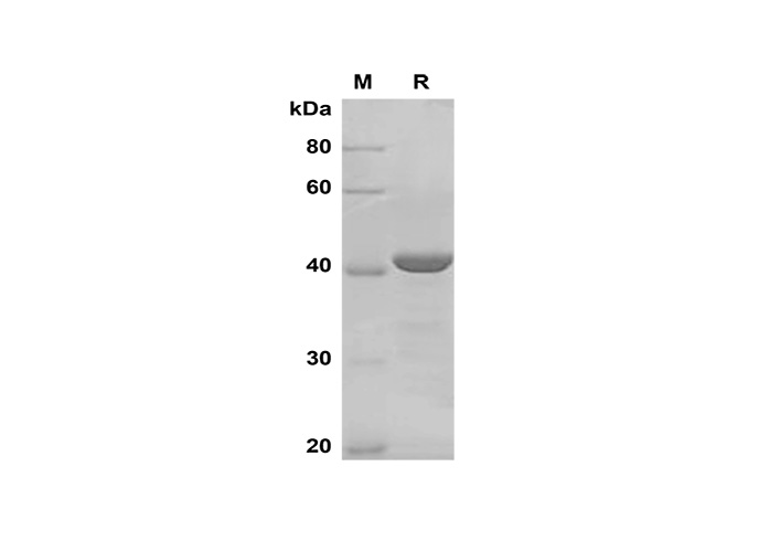 Recombinant Mouse DPPIV/CD26 Protein(Fc Tag)-产品推荐-1