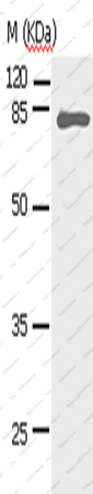 STAT5A Polyclonal Antibody - 1